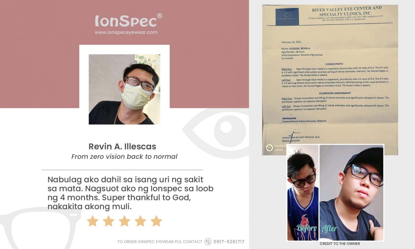 Ionspec-Eyewear-Blind-zero-visibility